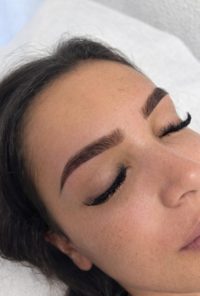 Epilation Bordeaux - Image 2