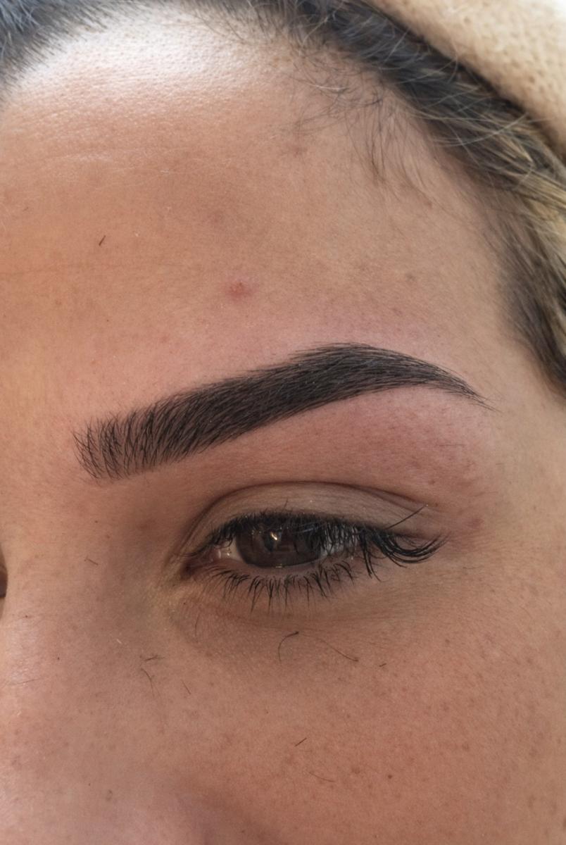 Epilation Bordeaux - Image 5