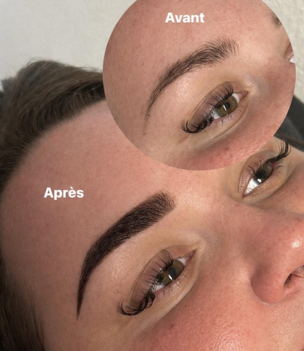 Epilation Bordeaux - Image 3